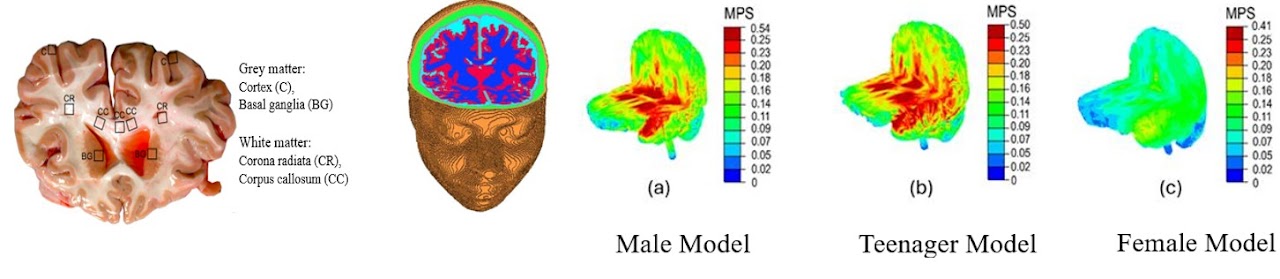 Brain Model Project